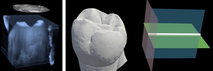 A dentist can view 3D scans of a tooth via Augmented Reality